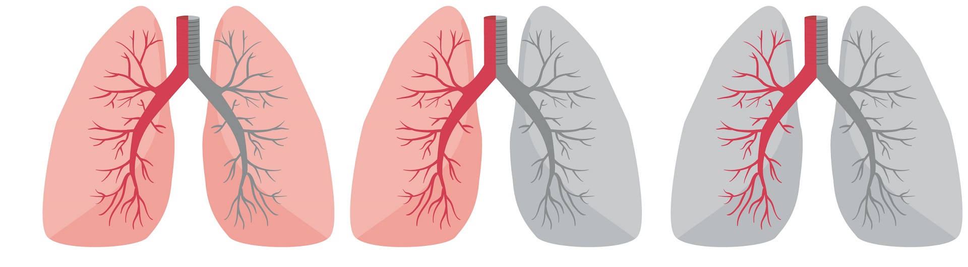 Curso MonitorizaciÃ³n y EvaluaciÃ³n de Pacientes con PatologÃ­a Respiratoria