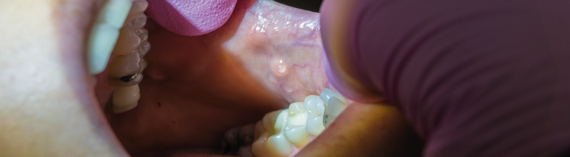 Curso CÃ¡ncer y PrecÃ¡ncer de la Cavidad Oral