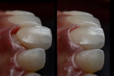 Diplomado de EstÃ©tica en RehabilitaciÃ³n Oral