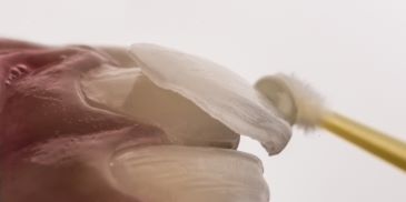 Diplomado de EstÃ©tica en RehabilitaciÃ³n Oral
