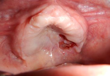 Diplomado en Medicina Oral