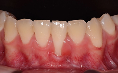 Programa de EspecializaciÃ³n en Periodoncia