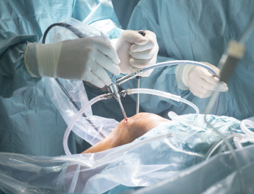 EstadÃ­a de Perfeccionamiento (Fellowship) en CirugÃ­a de Rodilla y ArtroscopÃ­a