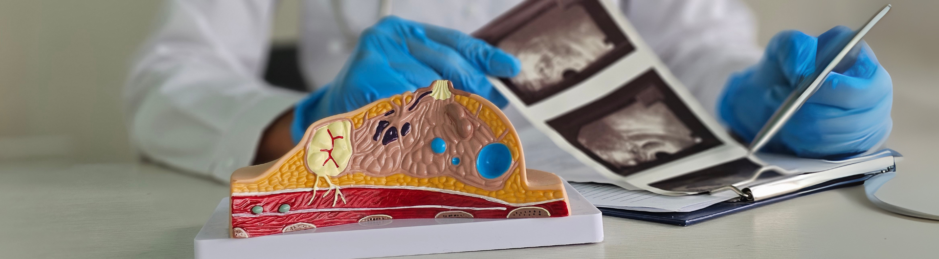 Especialidad MÃ©dica enÂ MastologÃ­a